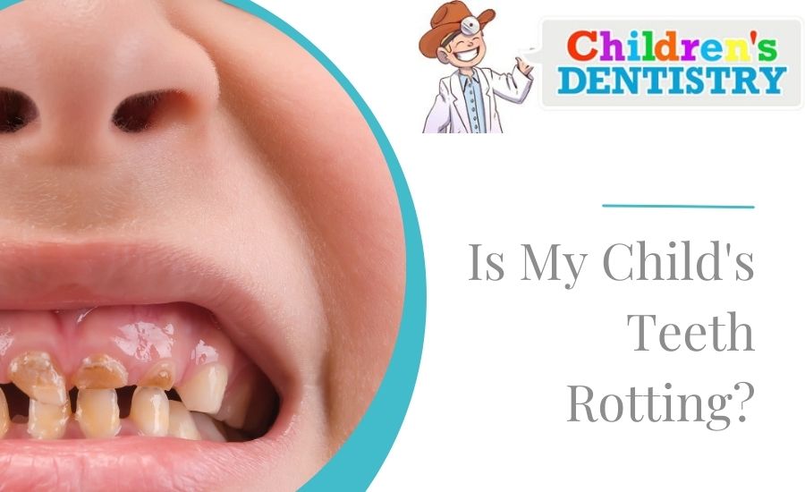 Is My Child's Teeth Rotting