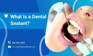 What is a Dental Sealant and Can My Child Benefit From Them?